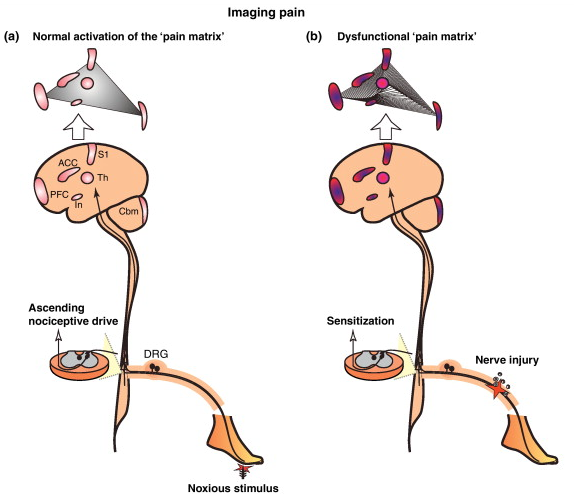 2164_Pain pathology.png